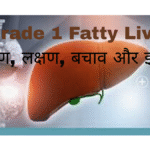 symptoms and prevention tips for Grade 1 Fatty Liver